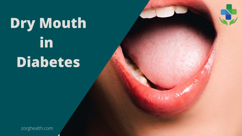 Dry mouth in diabetes