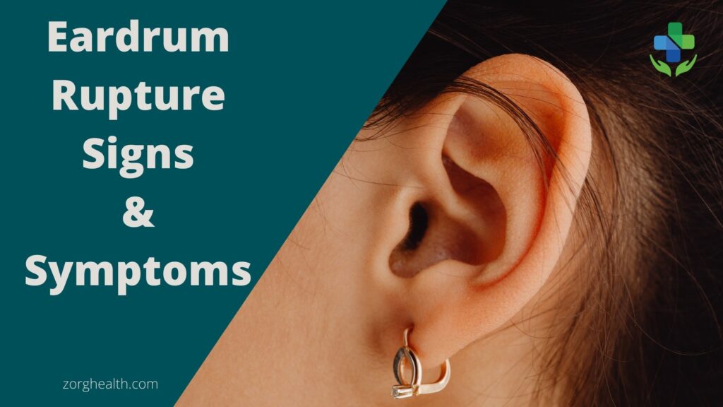 Ear drum Rupture Signs and Symptoms
