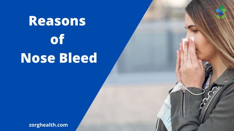 Reasons of Nose Bleed - Zorg Health