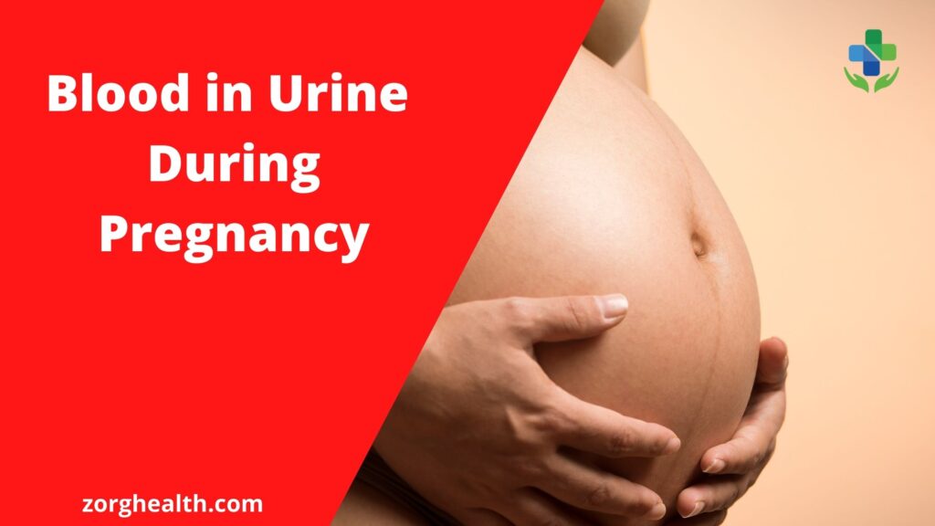 Blood in Urine during Pregnancy