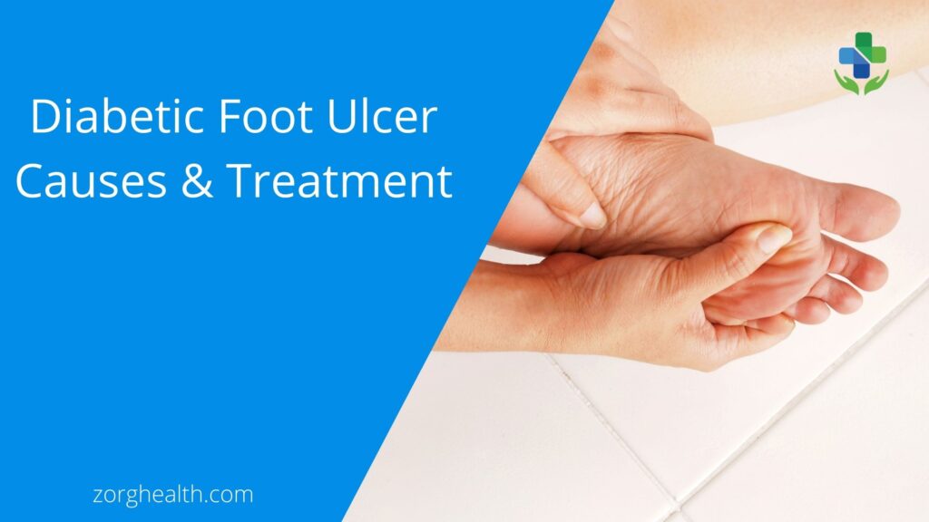 What is Diabetic Foot Ulcer Causes & Treatment - Zorg Health