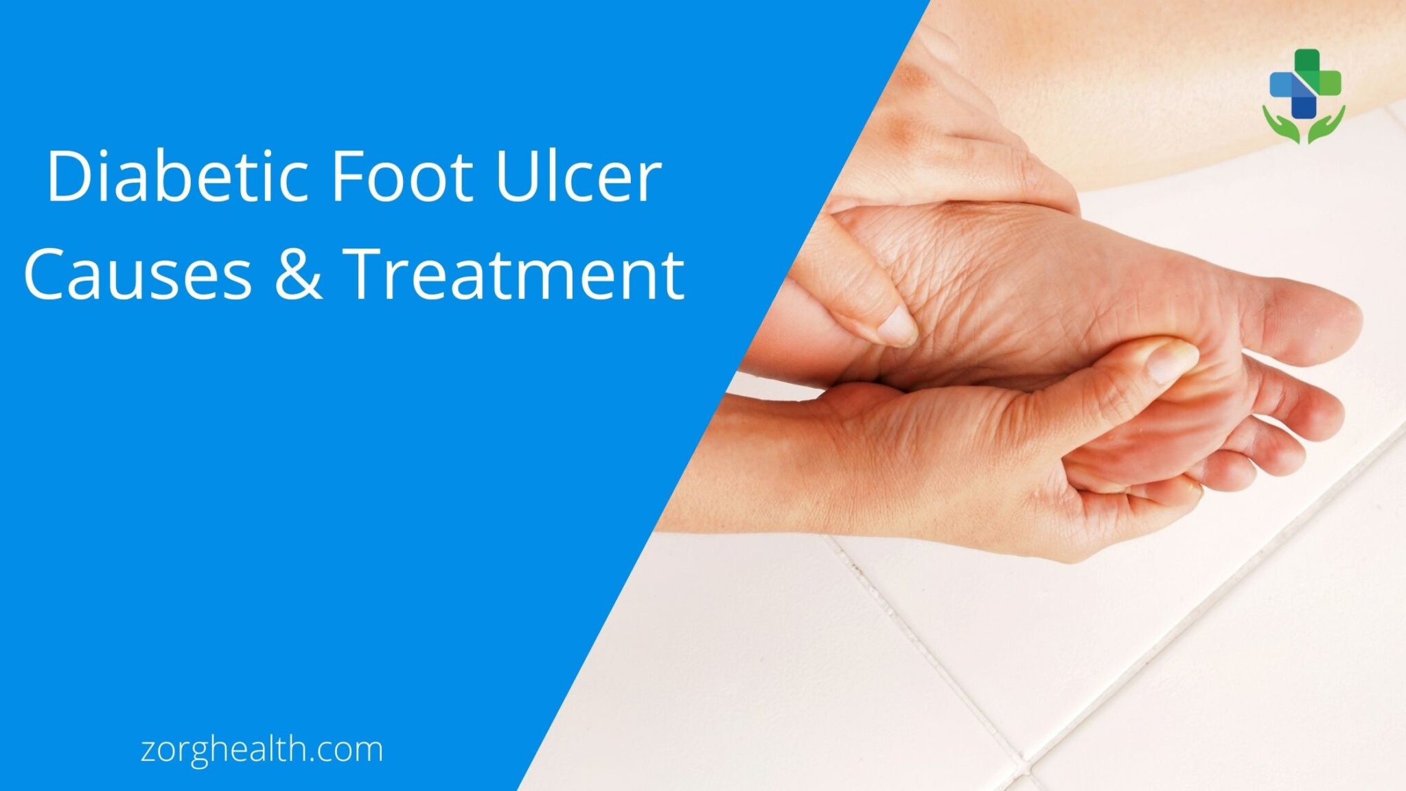 What Is Diabetic Foot Ulcer Causes And Treatment Zorg Health 2397