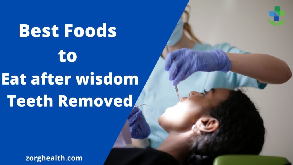Foods to eat after wisdom teeth removed