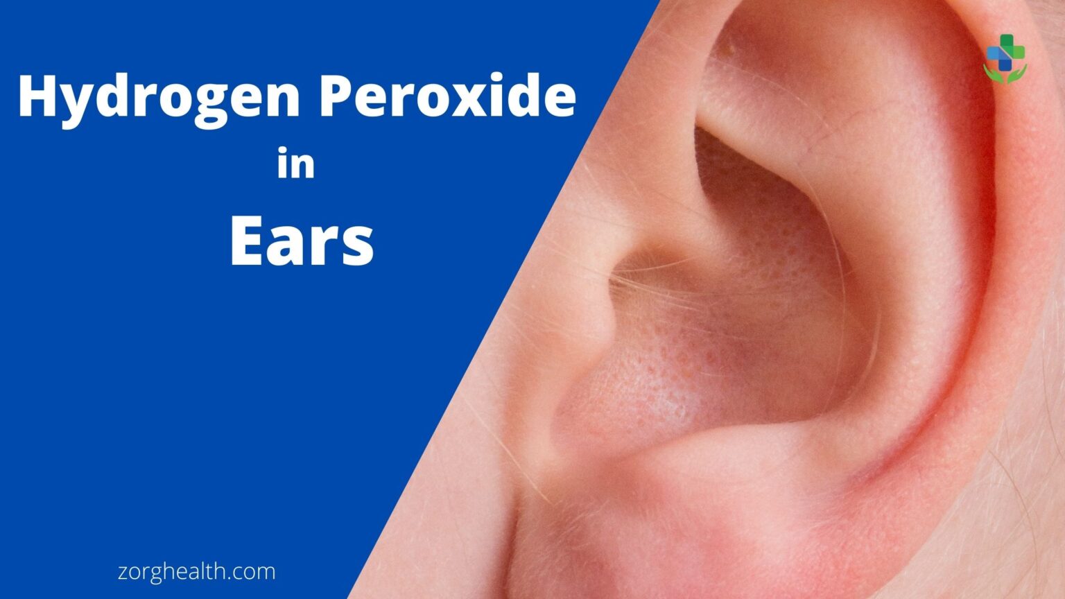 Use Of Hydrogen Peroxide For The Ears - Zorg Health