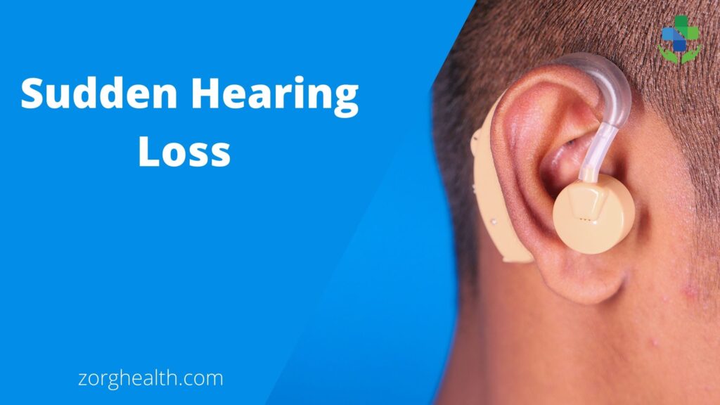 Sudden hearing loss Sensorineural