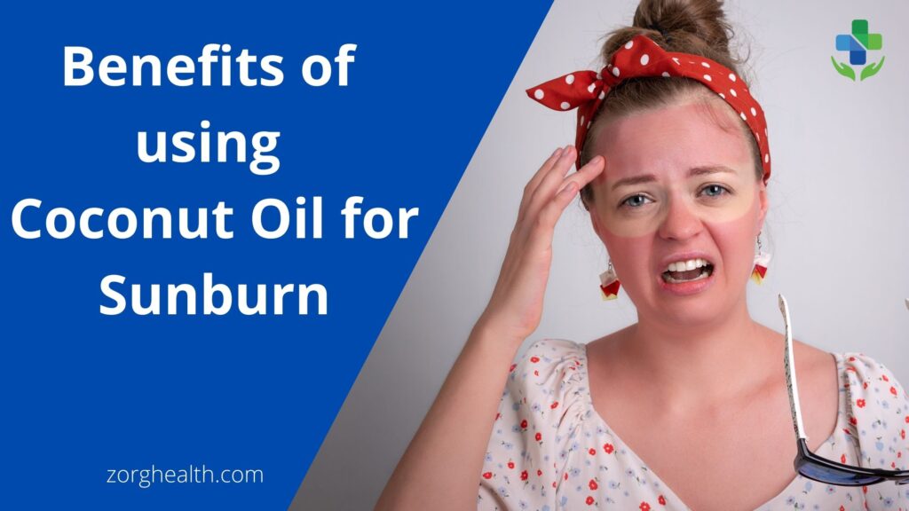 benefits-of-using-coconut-oil-for-sunburn-zorg-health