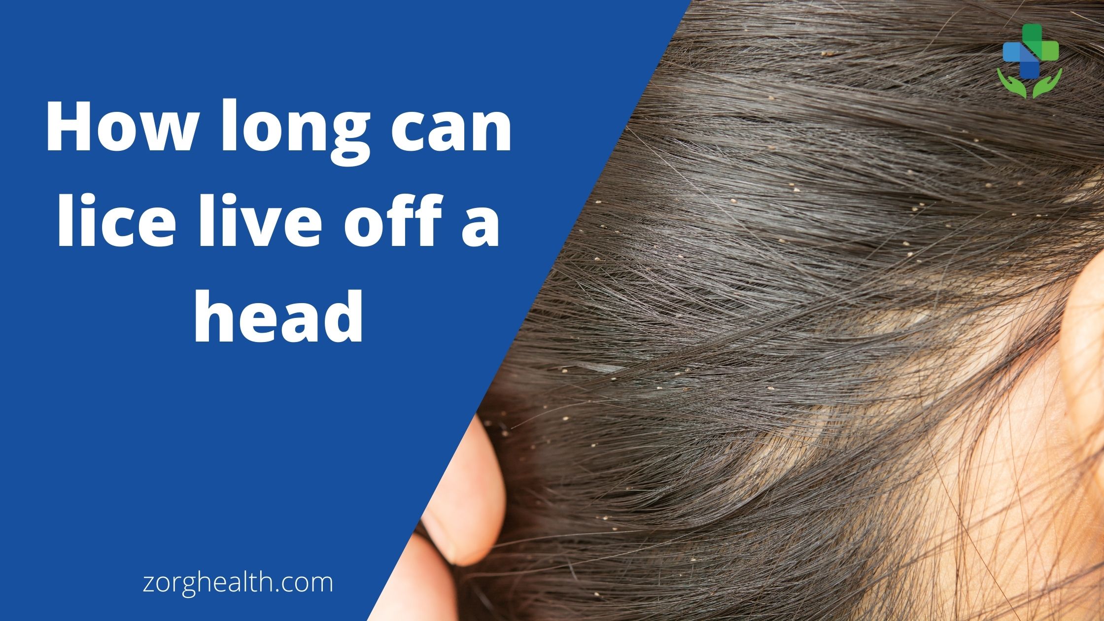 How Long Can Lice Live Off A Head Zorg Health